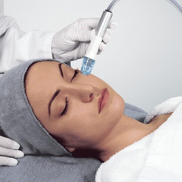 Higiene Profunda con Microdermoabrasión: Renovación, limpieza y luminosidad facial