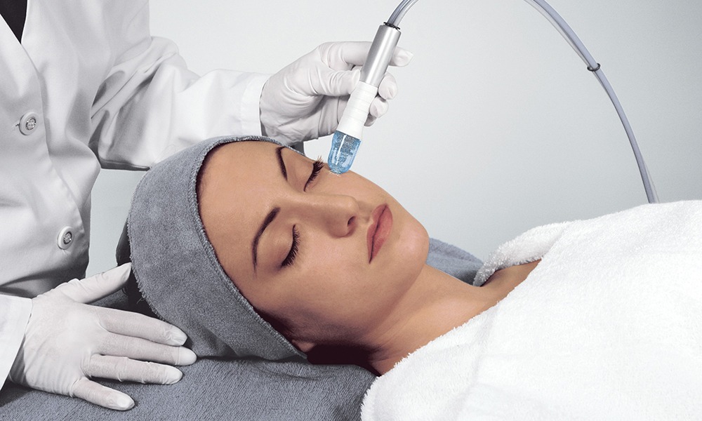 Higiene Profunda con Microdermoabrasión: Renovación, limpieza y luminosidad facial